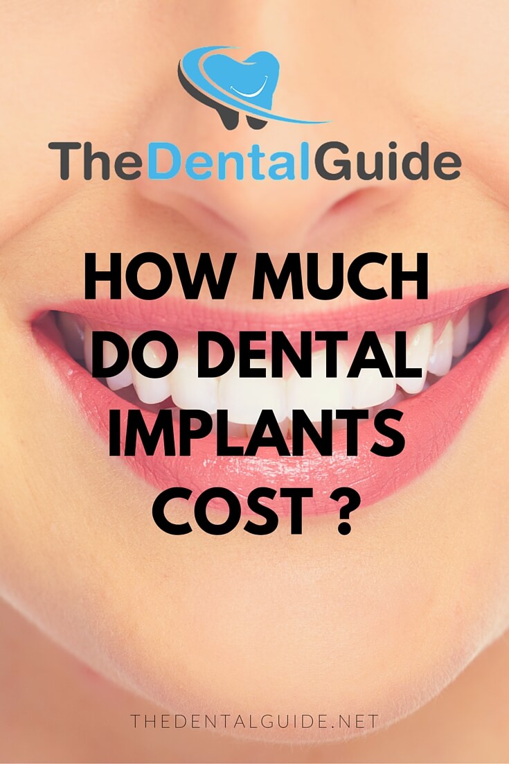 Dental Implants Costs Information The Dental Guide