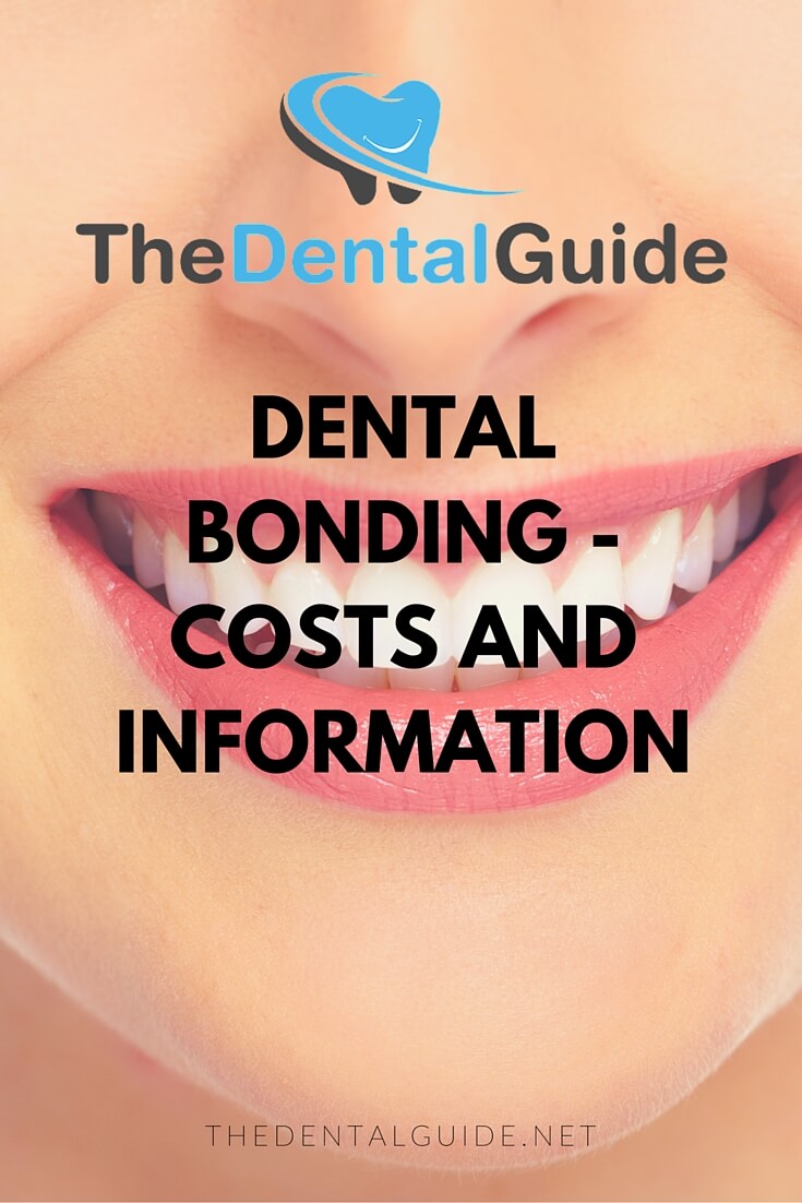 dental veneers bridges costs press teeth bonding whitening instant cost much does guide treatment