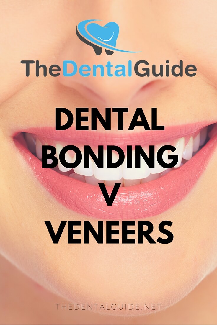 Dental Bonding v Veneers The Dental Guide