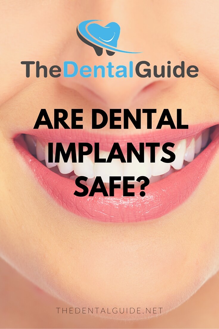 are-dental-implants-safe-the-dental-guide