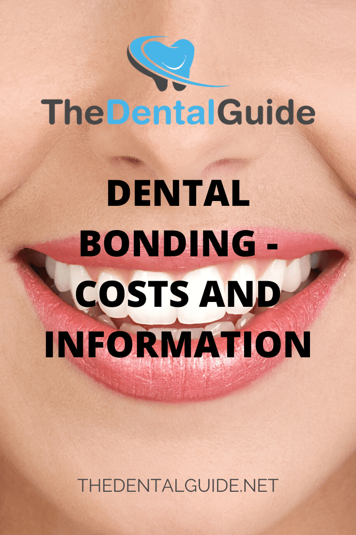How Much Does Dental Bonding Cost in the UK? - Dental Guide