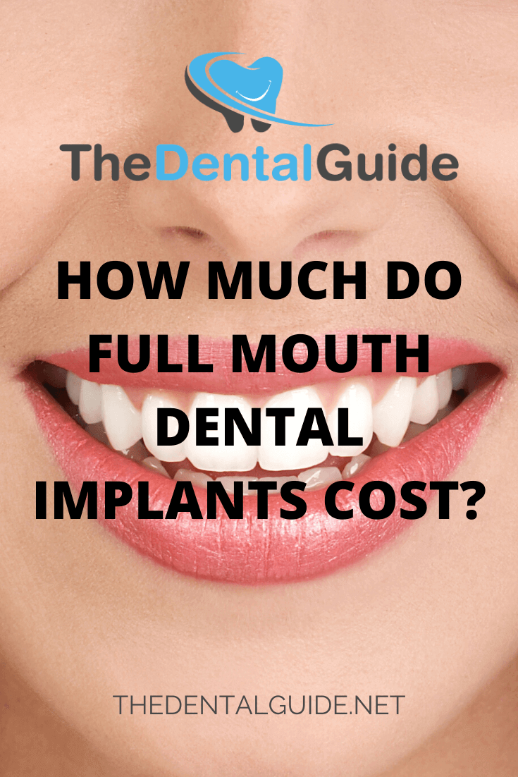 Full Mouth Dental Implants The Dental Guide