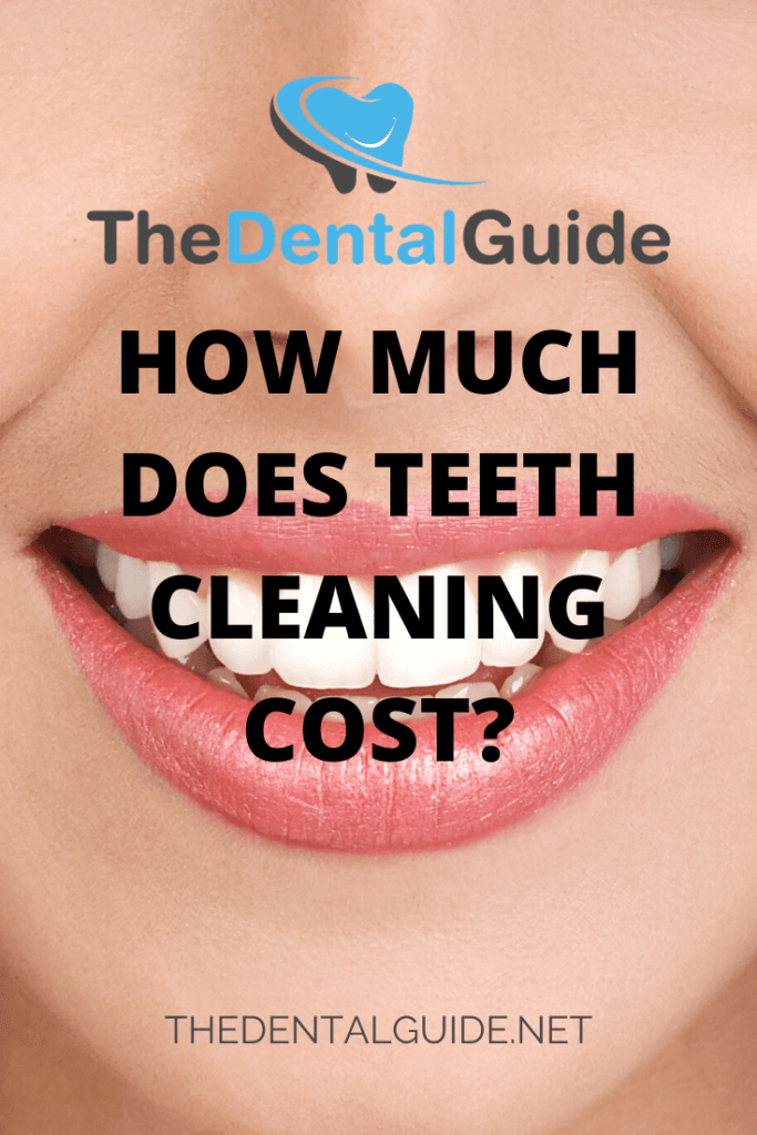 How Much Does A Deep Cleaning Cost Teeth at Lillie Connie blog