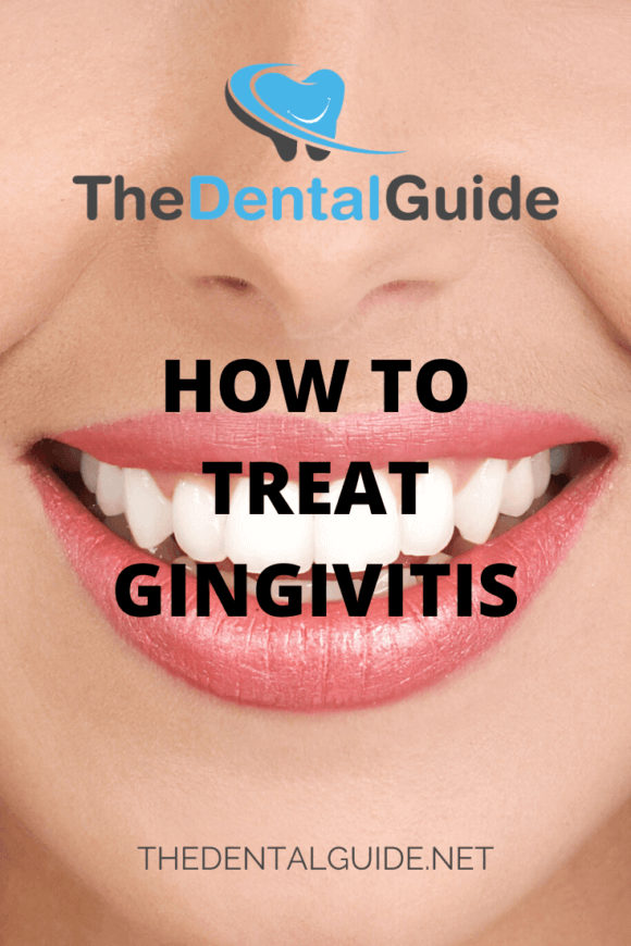 How To Treat Gingivitis - The Dental Guide