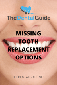 Missing Tooth Replacement Options - The Dental Guide