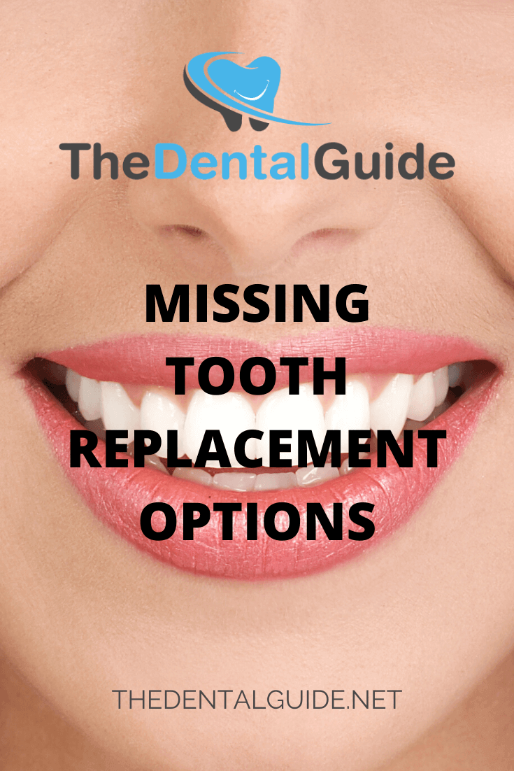 Missing Tooth Replacement Options The Dental Guide   Missing Tooth Replacement Options 1 